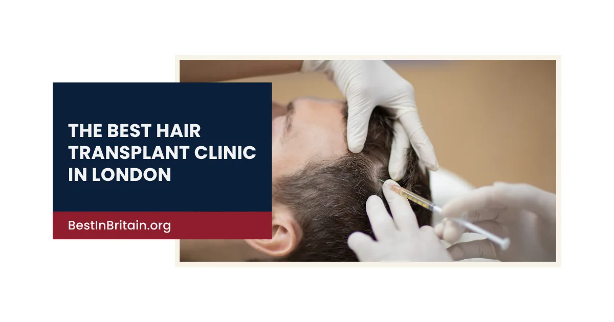 4 Best Hair Transplant Clinics in London